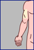 upper arms