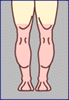 Oberschenkel
