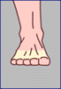 forefoot